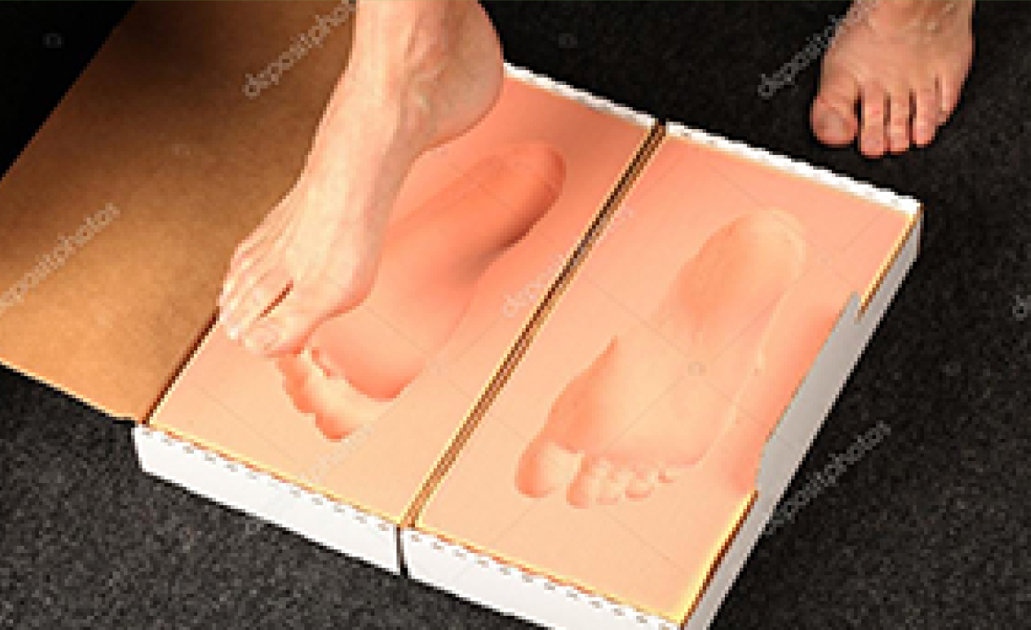 Casting for Orthotics On the Ball Orthotics, Barrie ON