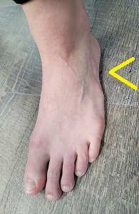 Location of the cuboid from the side of the foot.