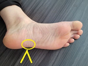 Location of the cuboid from the bottom of the foot.