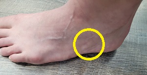 Location of the cuboid from the top/side of the foot.