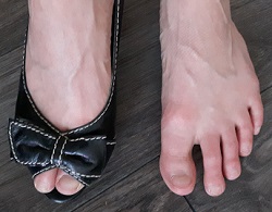 A foot crammed in a dress shoe