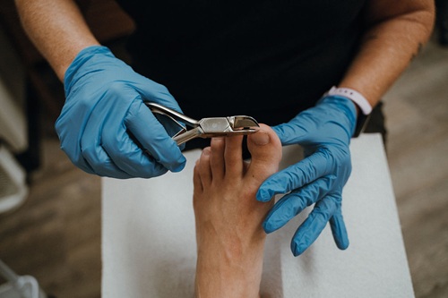 Footcare nurse trimming the big toe with nippers