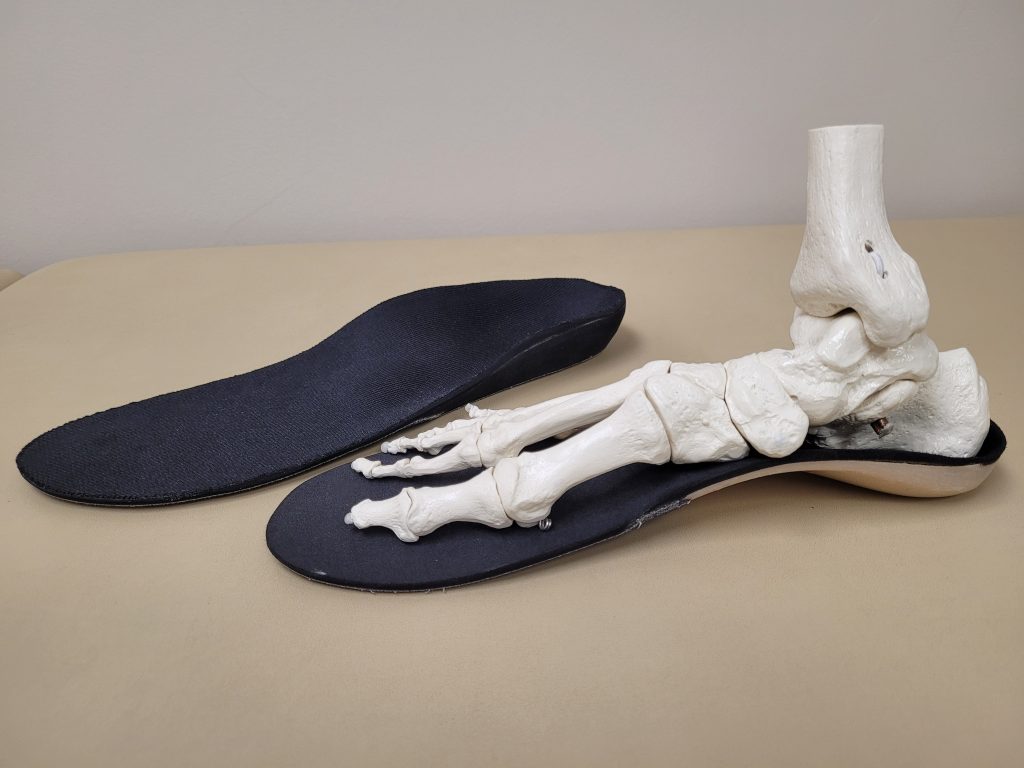 2 orthotics with a skeleton foot sitting on one orthotic